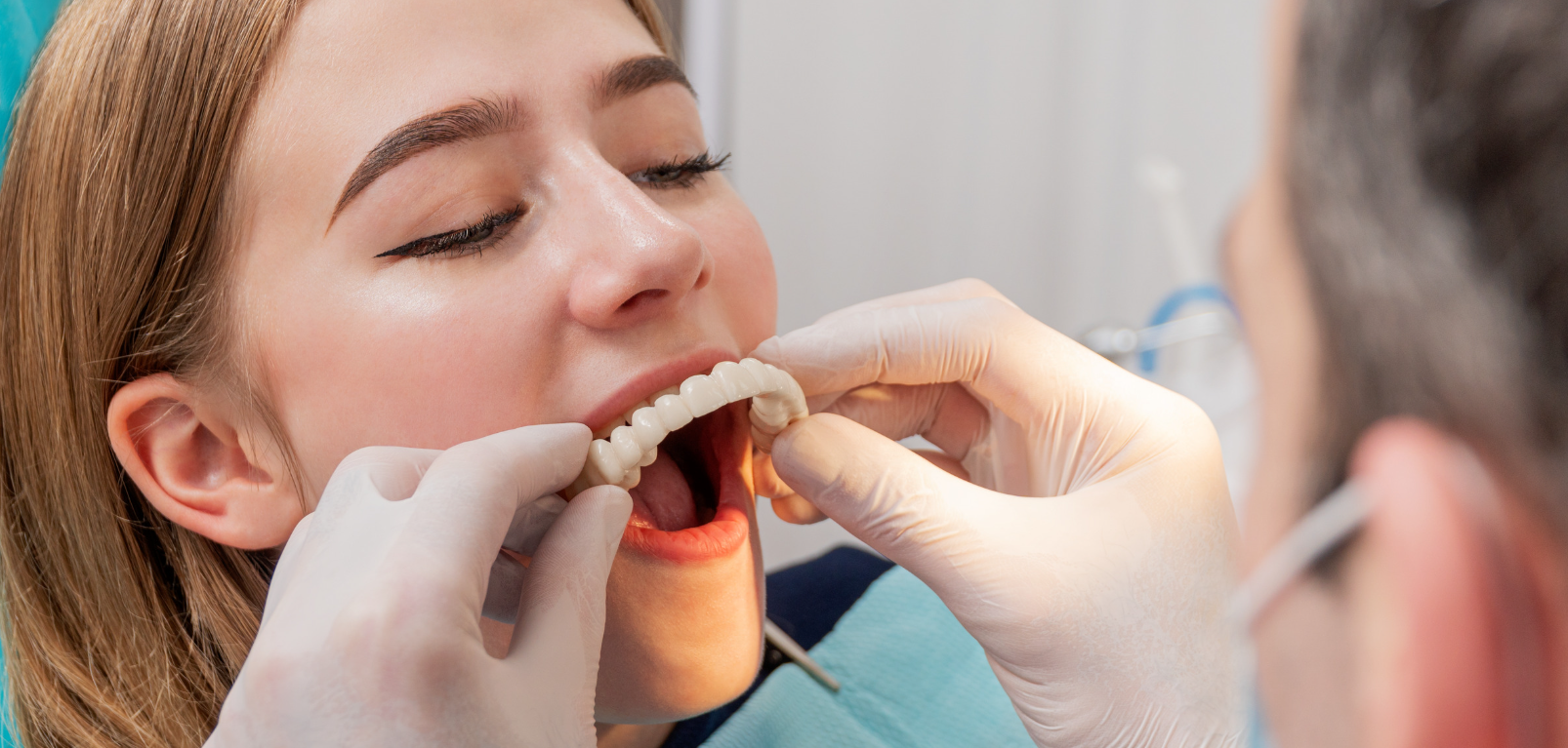Denture fitting at Grafton Smiles, North Grafton MA