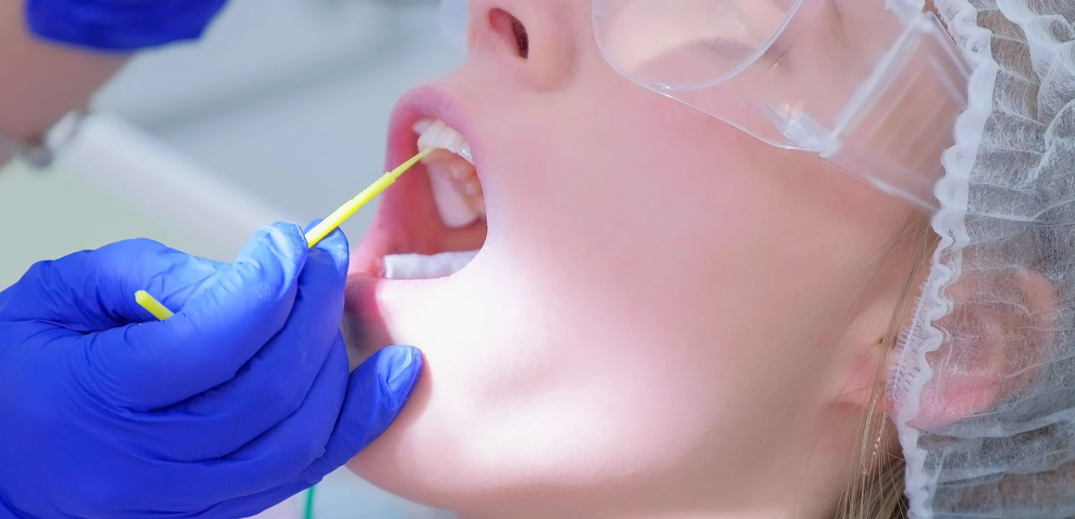 Fluoride treatment at Grafton Smiles, North Grafton MA