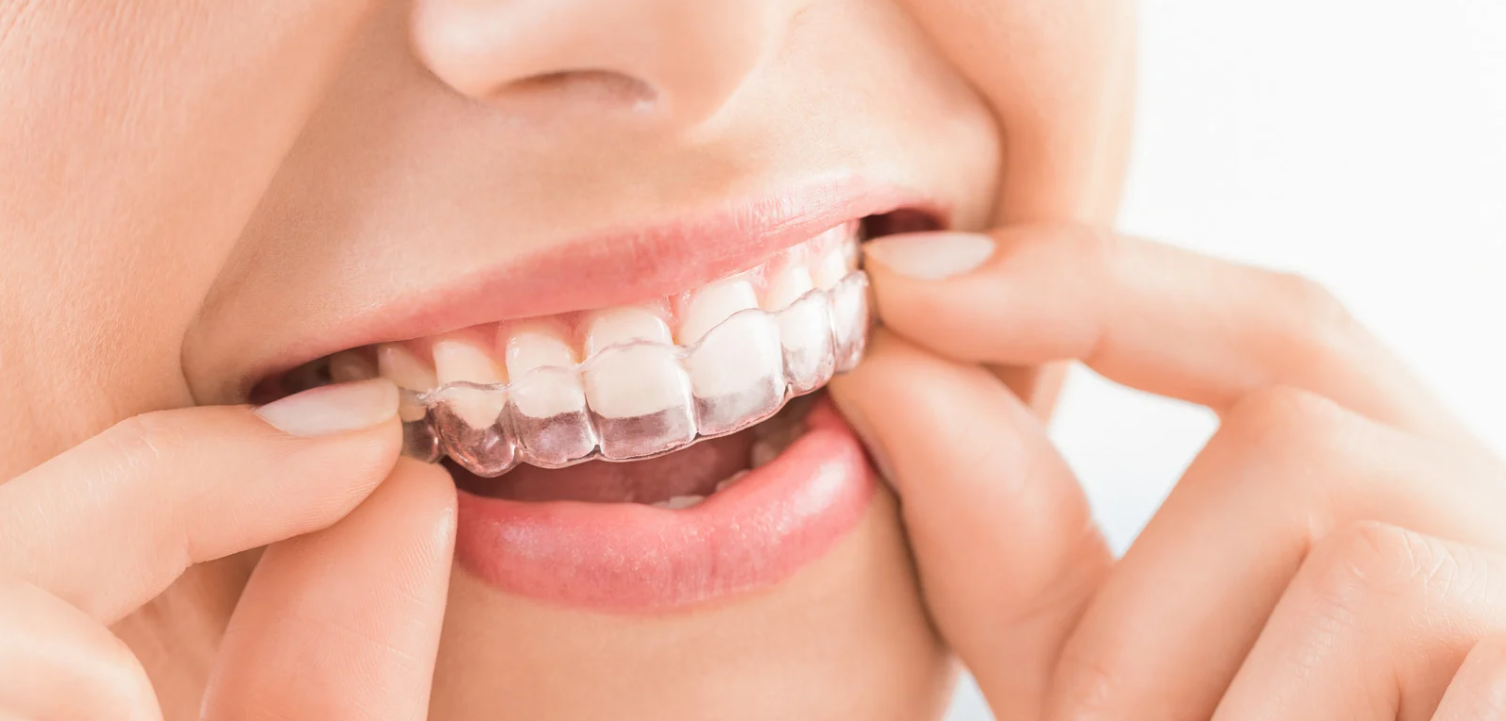 Invisalign outcome preview at Grafton Smiles, North Grafton MA