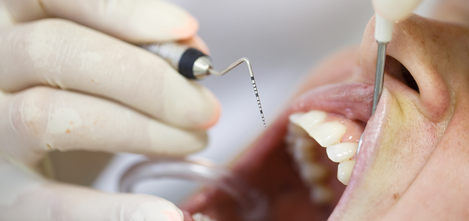 Periodontal maintenance at Grafton Smiles, North Grafton MA
