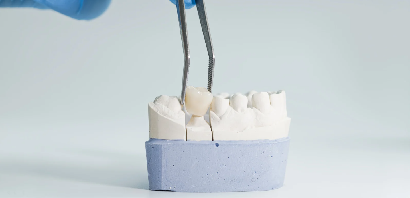 A same-day crown being prepared at Grafton Smiles, North Grafton MA