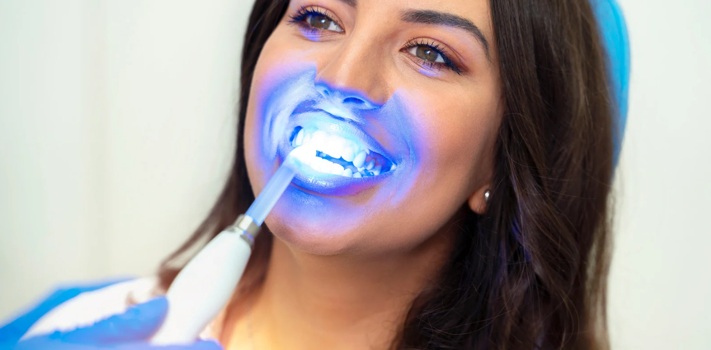 Professional teeth whitening at Grafton Smiles, North Grafton MA
