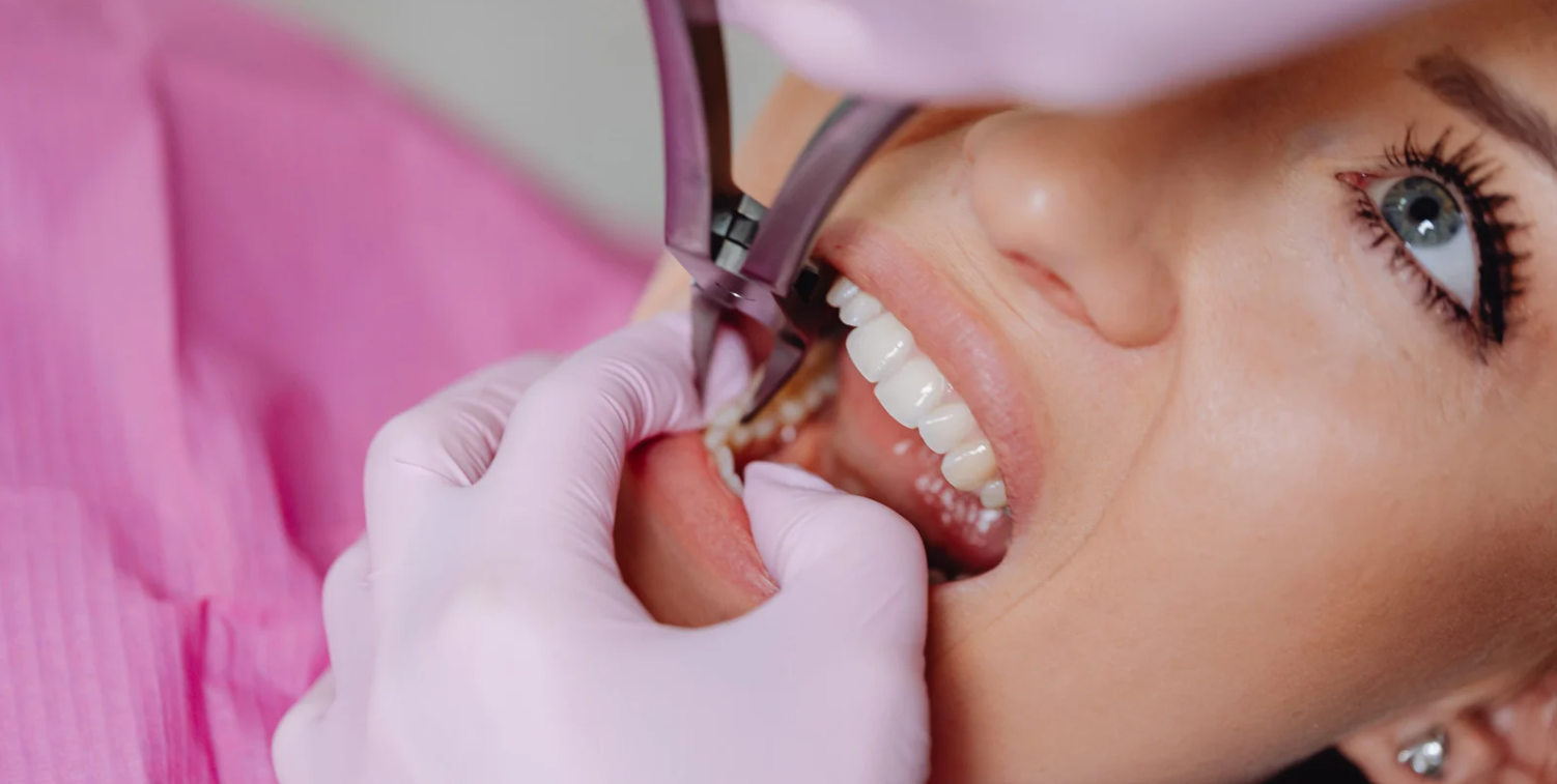 Tooth extraction care at Grafton Smiles, North Grafton MA