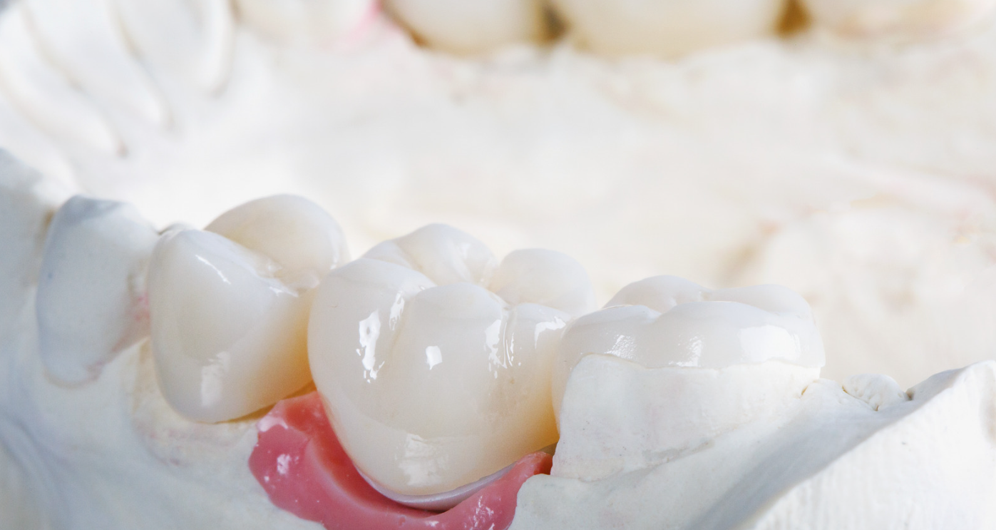 Crown vs filling assessment at Grafton Smiles, North Grafton MA